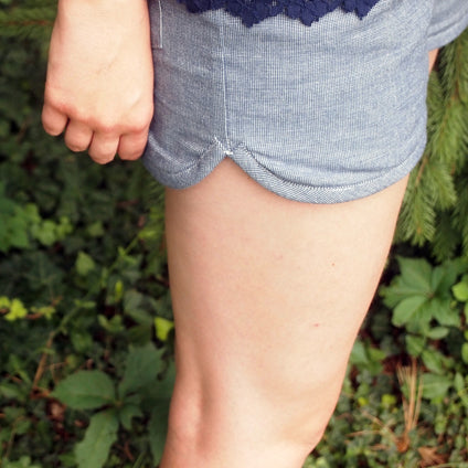 Close-up of Maritime Shorts in blue chambray showing scalloped hem detail, worn with a navy lace top outdoors